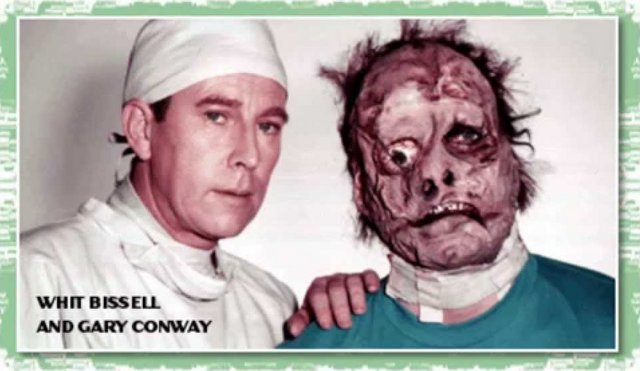 I Was a Teenage Frankenstein (1957)